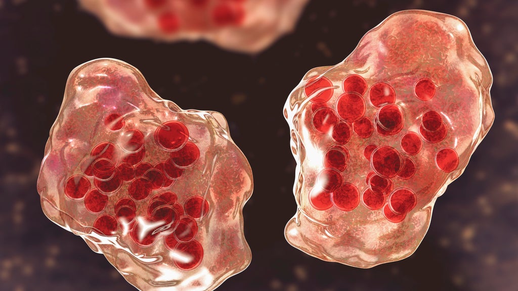 Central Minnesota county reports "several cases of suspected measles" — WCCO / CBS Minnesota, Orono Health news