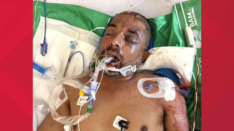 University Hospital asks for help identifying unconscious patient hit by truck Saturday evening — KENS 5 (San Antonio), Orono Health news